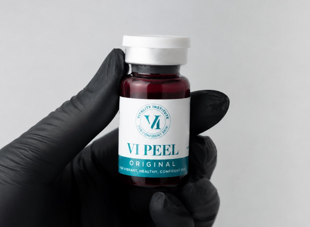 A gloved hand holding a VI Peel Original vial at Anato Aesthetics